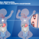OPBG Atresia esofagea la tecnica della magneto anastomosi orizzontale 3 300x300 eN41Pe